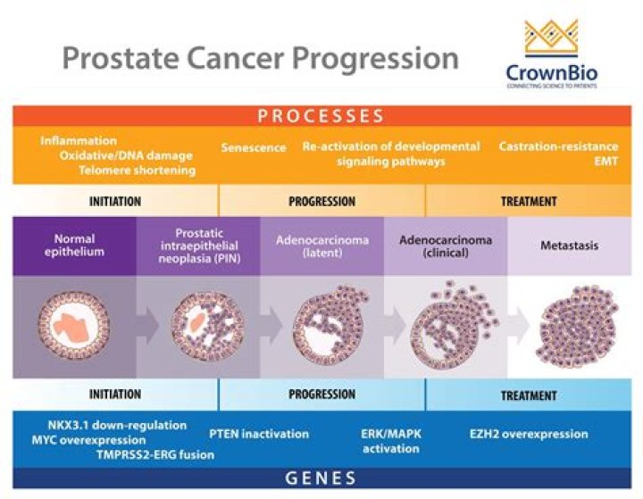 Insights Into Prostate Cancer And Beyond