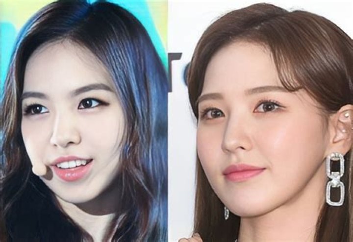 Red Velvet Wendy Plastic Surgery, Nose Job Before And After Photos